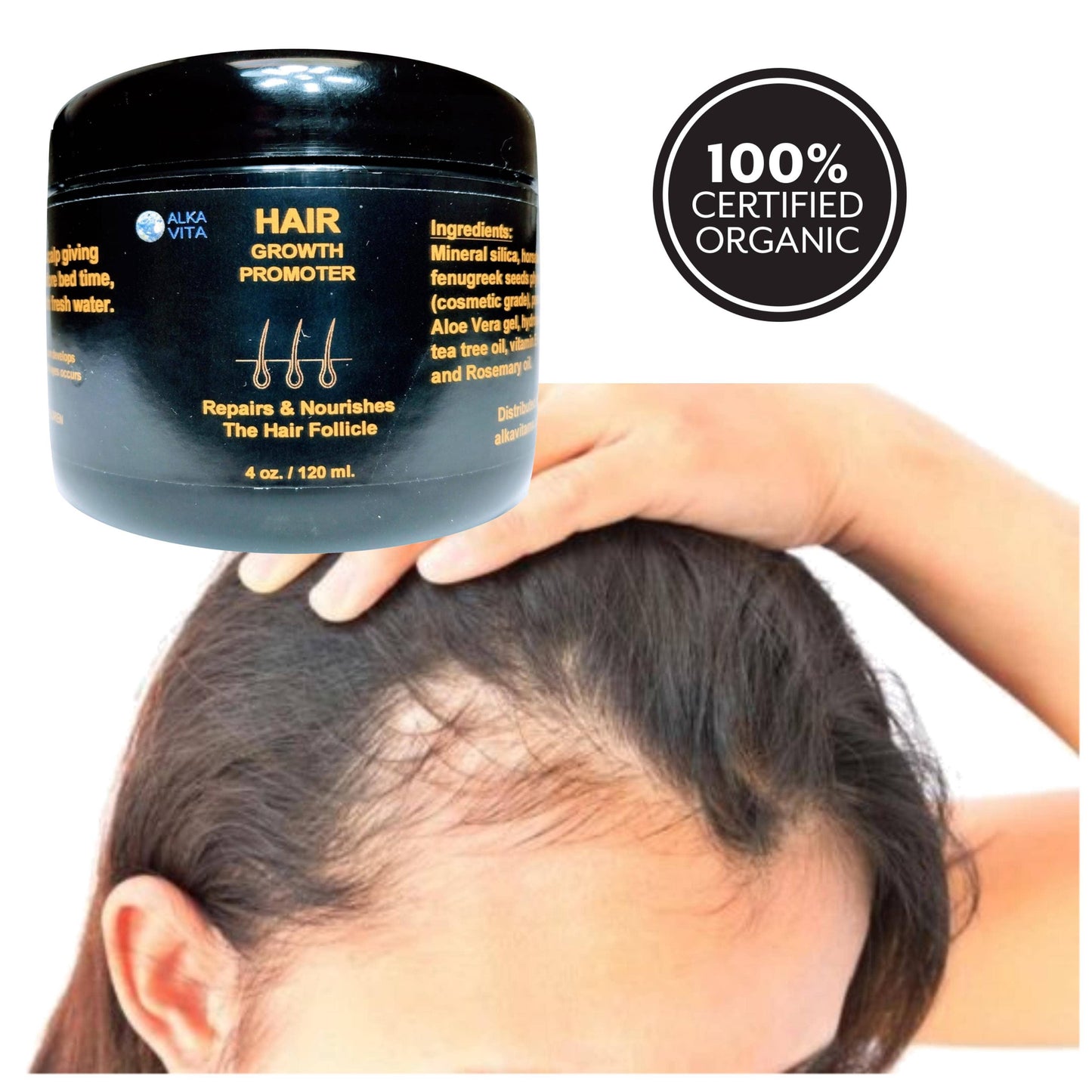 Hair Growth Promoter Alopecia Silica Fenugreek & Peanut Gel