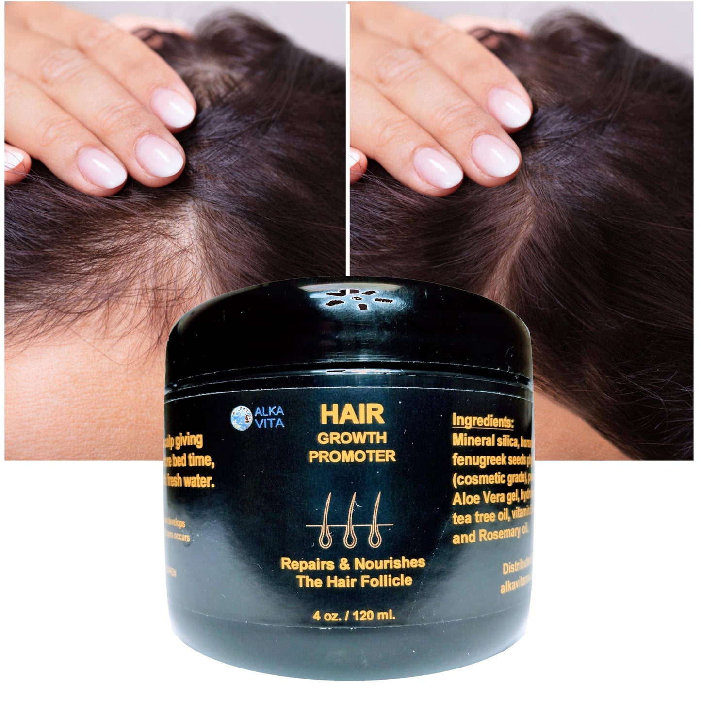 Hair Growth Promoter Alopecia Silica Fenugreek & Peanut Gel