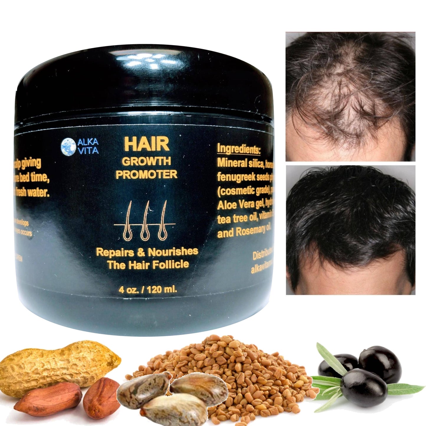 Hair Growth Promoter Alopecia Silica Fenugreek & Peanut Gel